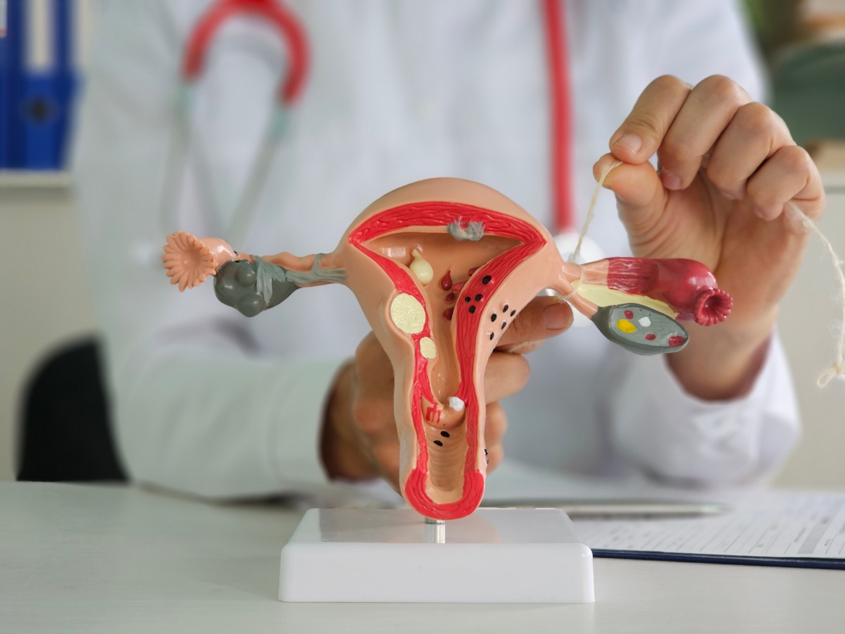 Hormone PCOD Profile
