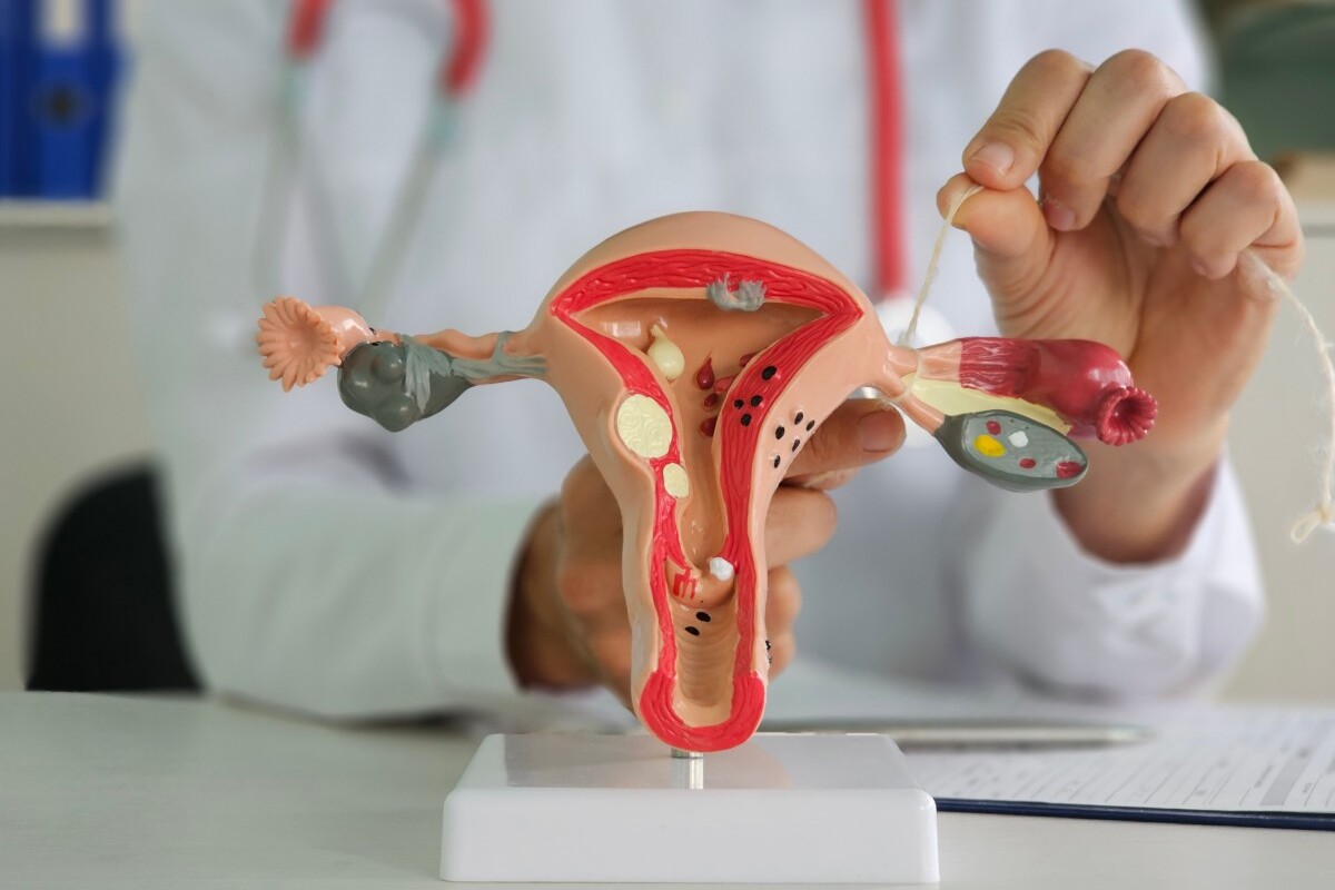 Hormone PCOD Profile